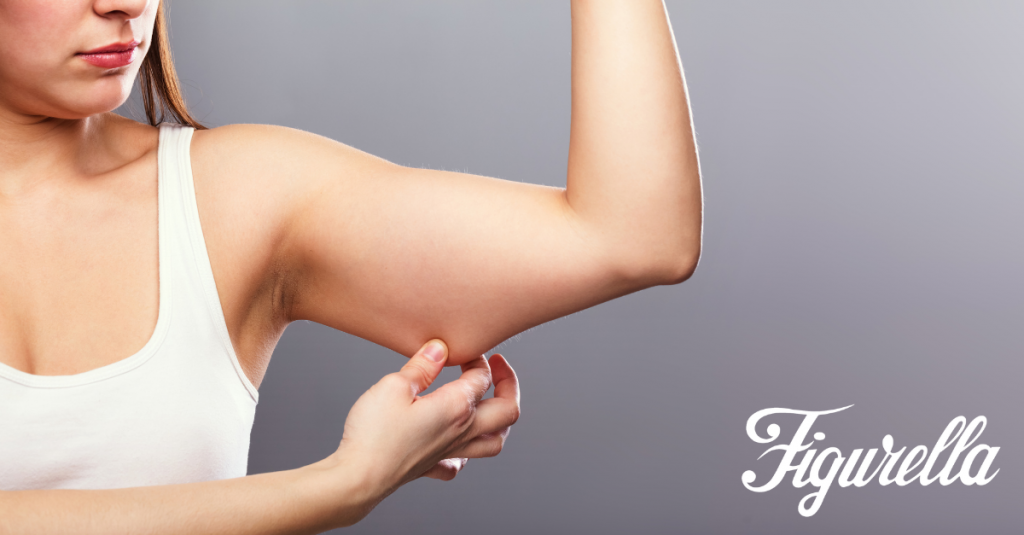 arms fat removal the natural approach with Figurella